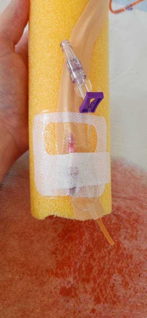 diy fake iv bag|diy iv arm.